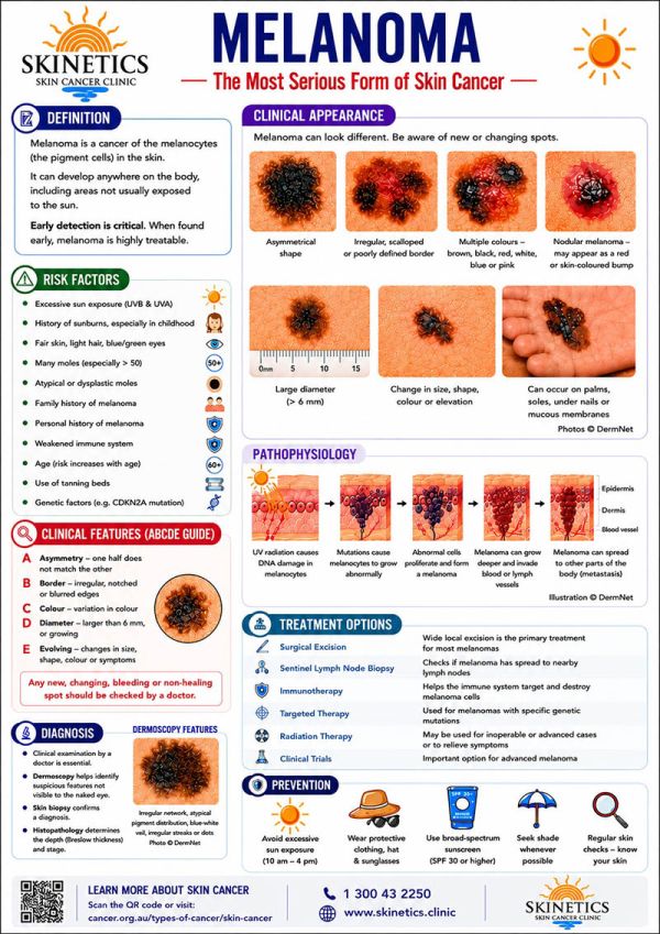 skinetics-melanoma-poster-final-a43813B7FB-2FAB-8334-24DF-0DA1D405194A.jpg